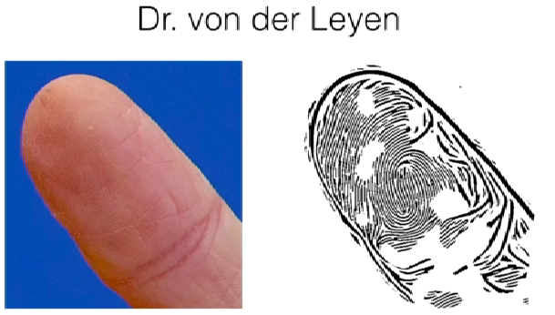 Fingerabdruck